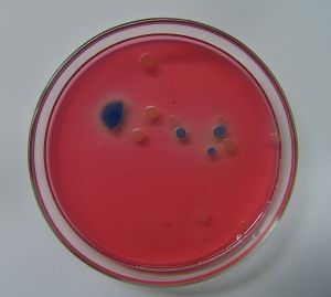 e-coli-1041951-m